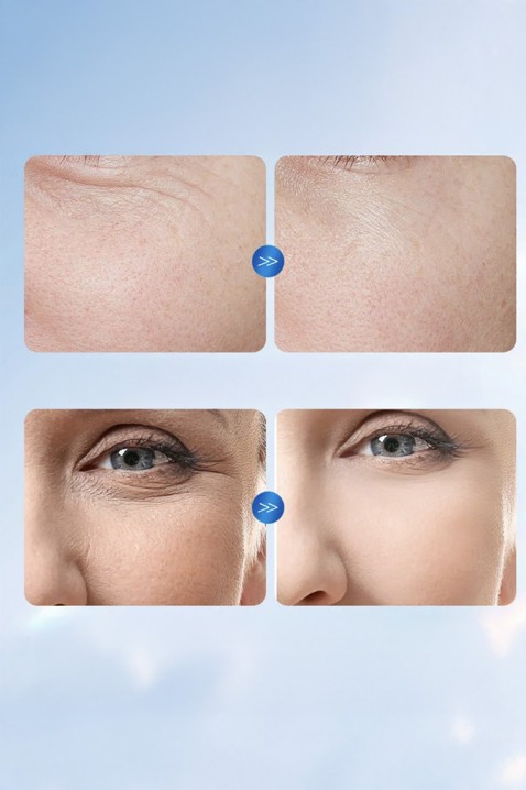 Αμπούλες προσώπου SADOER Hyaluronic AcidIVET.EU - Εκπτώσεις έως -80%