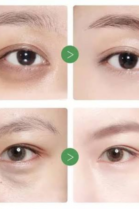 Mary&May Tranexamic Acid + Glutathion Eye Cream, 30 gIVET.EU - Εκπτώσεις έως -80%